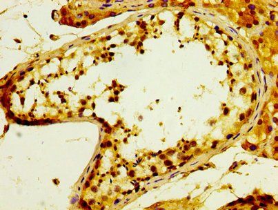 POFUT2 Antibody