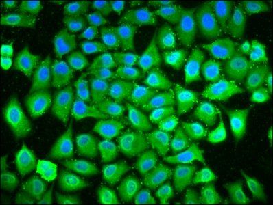POLDIP3 Antibody