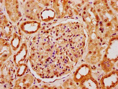 POLE4 Antibody