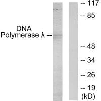 POLL Antibody