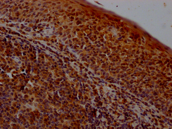 POLR2A Antibody