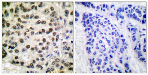 POLR2A (Ab-1619) Antibody