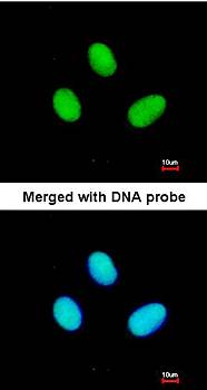 POLR2B antibody