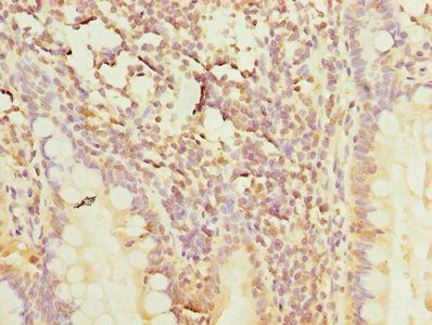 POLR3A Antibody