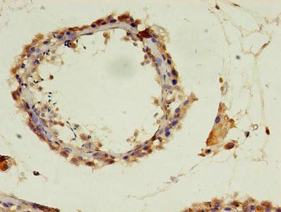 POLR3A Antibody