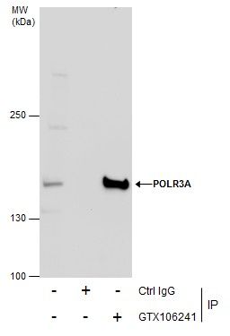 RNA polymerase III subunit A Antibody