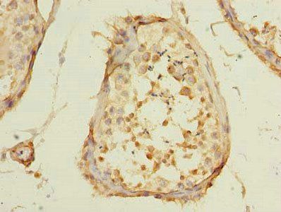 POLR3E Antibody