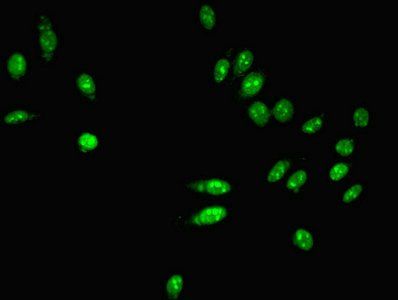 PARN Antibody