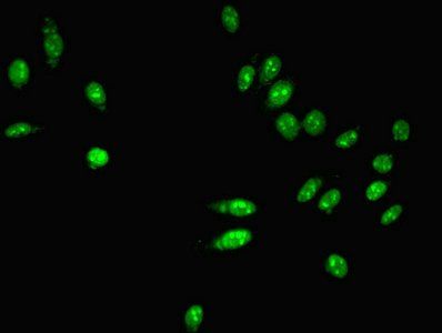 Poly(A)-specific ribonuclease PARN antibody