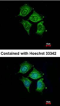 POMGNT1 antibody