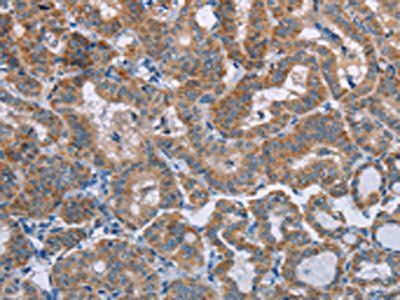 POMT1 Antibody