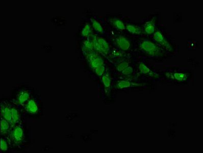 POT1 antibody