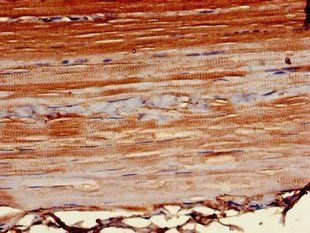 POT1 Antibody