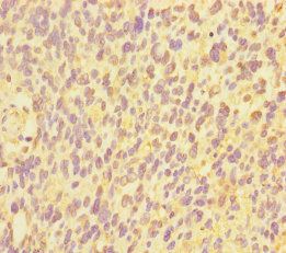 POU5F1 Antibody