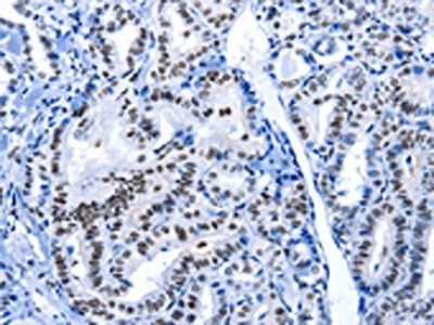 POU2AF1 Antibody