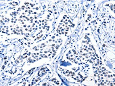 POU2AF1 Antibody