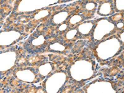 POU2F2 Antibody