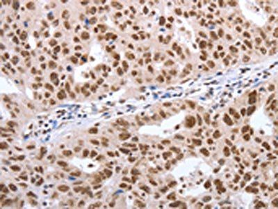 POU3F1 Antibody