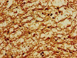POU3F1 Antibody