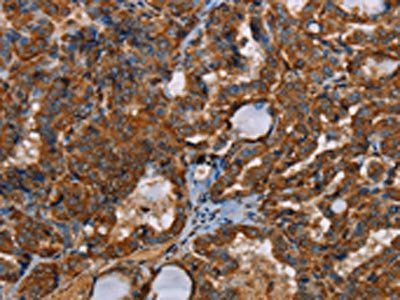 POU6F2 Antibody