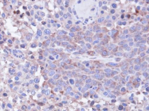 PP1C gamma antibody [N1C2]