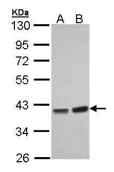 PP1C gamma antibody [N1C2]