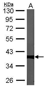 PP1C gamma antibody [N1C2]