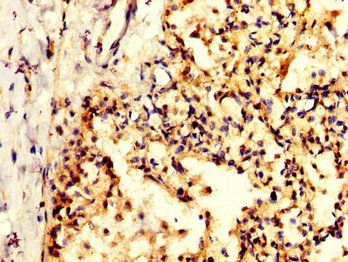 PPA1 antibody