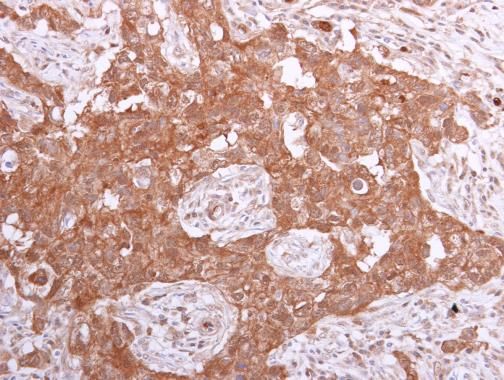 PPA1 antibody