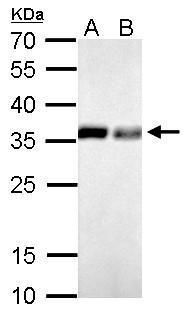 pyrophosphatase (inorganic) 1 Antibody