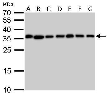 pyrophosphatase (inorganic) 1 Antibody