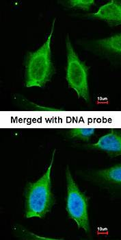 PPA1 antibody