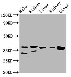 PPA2 Antibody