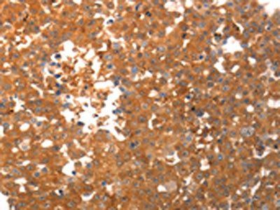 PPAP2C antibody