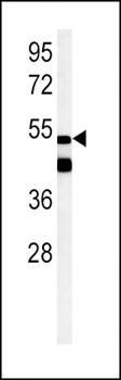 PPARG antibody