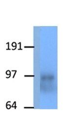 PPARGC1A antibody