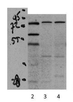 PPARGC1A antibody