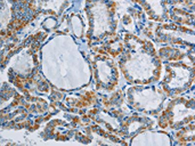 PPARGC1B Antibody