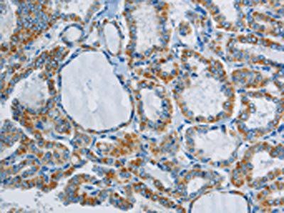 PPARGC1B antibody