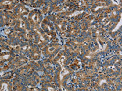 PPARGC1B antibody