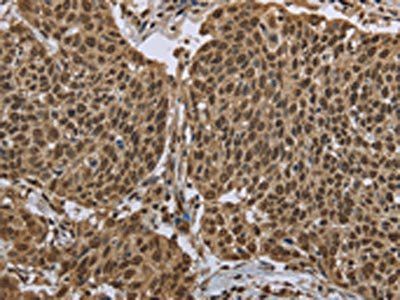 PPAT Antibody