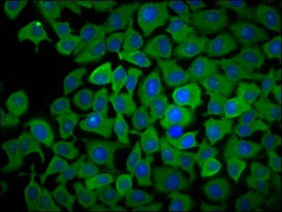 PPCDC antibody