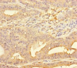 PPFIA1 Antibody