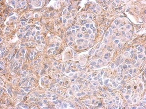 PPFIBP2 antibody