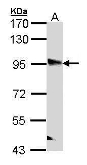 PPFIBP2 antibody