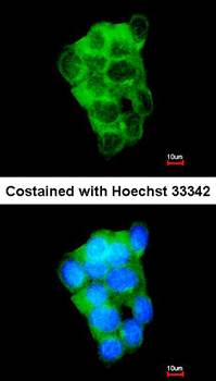 PPFIBP2 antibody