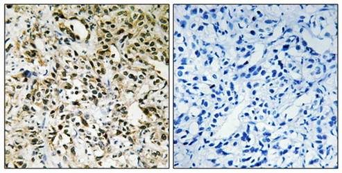 PPHLN Antibody