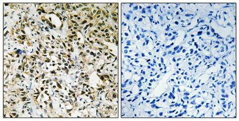 PPHLN antibody