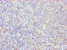 PPIB Antibody