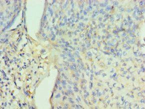 PPID Antibody